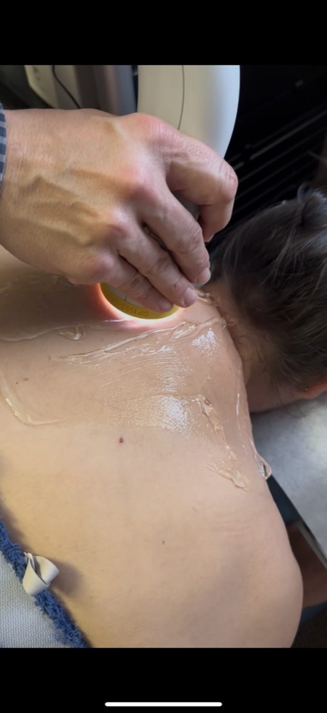 SoftWave therapy applicator delivering broad-focused shockwaves to a patient's neck and upper back at Hansen Chiropractic
