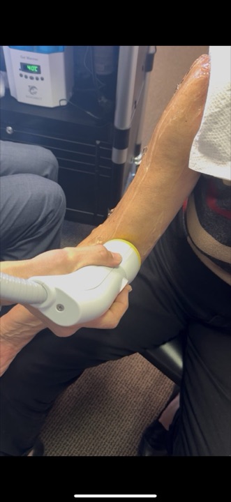 SoftWave therapy treatment for elbow and joint pain